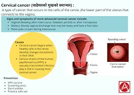 Maybe you would like to learn more about one of these? Cervical Cancer à¤ª à¤  à¤˜à¤°à¤• Alive Pharmaceutical Pvt Ltd Facebook