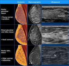 Breast cancer and some noncancerous (benign) breast conditions can appear white on a mammogram. The Radiology Assistant Ultrasound Of The Breast