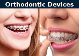 Orthodontist Burbank