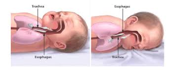 Image result for Sleep Problems in Infants