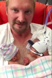 Millions Of People Have Fallen In Love With These Preemie Twins Holding  Hands