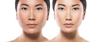With the rise of “lookism” in south korea, plastic surgery has grown from a subculture into a mainstream culture that penetrated deeply into the society. 53 Most Popular Plastic Surgery Procedures In Korea Seoul Guide Medical