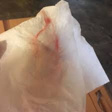 Even after the bloody show, you may have some time before the baby is delivered. Bloody Show How Long Should It Last August 2017 Babycenter Canada