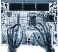 Using A Laptop X Ray Radiologie Radiographie Noir Et Blanc