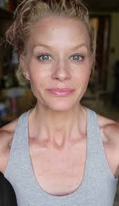 Awesome time at Infinity Skin Care with Betsy Desjardins! Took care of some  wrinkles & then did the IV Hydration.💧 Highly recommend both! Thanks Betty!