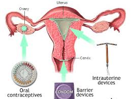 Bu makalede rahim ağzı kanserinin erken tanısında smear testinin önemi, rahim ağzına cinsel yolla bulaşan hpv' nin smear testi ile nasıl erken safhada rahim ağzı kanserine ilerlemeden yakalanabileceği vurgulanmaktadır. Rahim Endometrium Kanseri Prof Dr Husnu Gorgen