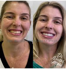 Mais importante que a velocidade, é a direção”. . . . . . . .