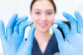 Expert Dentist in Mount Lawley, Perth