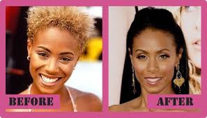 It is obvious that jada had some type of cheek . Jada Pinkett Smith Plastic Surgery Facelift Cheek Implants Botox