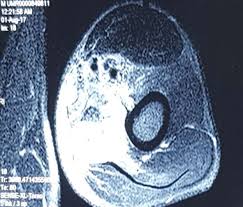 Case Report Series Bjmp Org