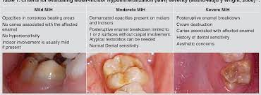 Mih home is one of the leading building materials company, supplier, & retailer in the uae, since 1975. Table 1 From Prevalence Of Molar Incisor Hypomineralization Mih In Children Seeking Dental Care At The Schools Of Dentistry Of The University Of Buenos Aires Argentina And University Of La Republica Uruguay
