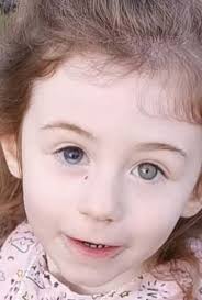 My daughter lost her eye to retinoblastoma 5 months after I had the 'all  clear' for breast cancer”