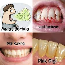 Karang gigi terbentuk karena adanya penumpukan plak yang dihasilkan dari endapan sisa makanan yang mengandung bakteri. Masalah Karang Gigi Gigi Kuning Mulut Berbau Home Facebook