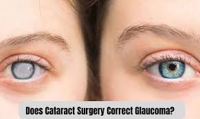 Image result for Glaucoma