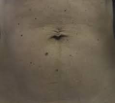 Loose stomach skin can also be just excess subcutaneous body fat that's right underneath your skin. What Can Be Done For My Saggy Belly Button Photos