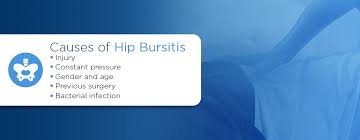 The bursa causes pain in the hip when subjected to continual trauma resulting in swelling and inflammation. Types Of Bursitis Explained Orthobethesda