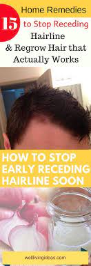 How To Stop Receding Hairline And Regrow Hair Naturally Reverse A Receding Hairline 15 Home Remedies F Regrow Hair Regrow Hair Naturally Receding Hair Styles