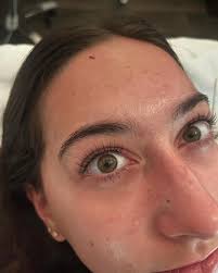 Anna Dinsmore, LME (@anna.aestheticss) • Instagram photos and videos