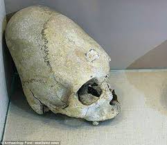 Deformed Alien Child S Skull Found In Crimea Daily Mail Online Many researchers enthusiastically call elongated skulls evidence of the existence of forbidden archeology. daily mail