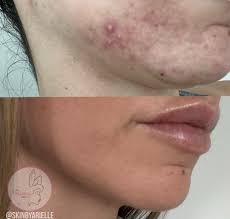 ARIELLE SINESI ♡ THE SKIN MERMAID 🧜🏼‍♀️