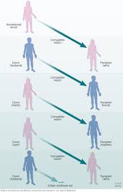 kidney transplant mayo clinic