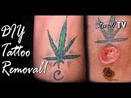 Expand your knowledge of tattoos. Diy Tattoo Removal Steve O Tv Youtube