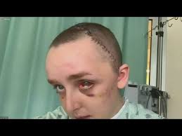 Columbia College student Annie Shea Wheeler can't remember being crushed by  falling façade in Wicker