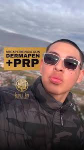 Tú puedes ser el siguiente… “Pase de 7 clientes a la semana a 7 clientes…  al día”. Arielen Fortes, pionera en micropuntura brasileña en Perú y dueña  de empresa DermaFit en Miraflores -