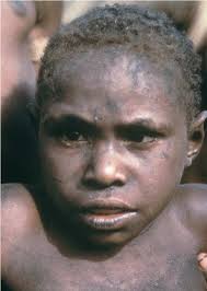 PDF] Early images of kuru and the people of Okapa