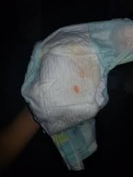 Manchas Naranjas En Panal Club De Bebes Mayo 2018 Babycenter