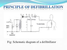 Defibrillator meaning, definition, what is defibrillator: Defibrillator Ppt