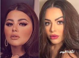 من جانبها، عبرت الفنانة هنادي مهنا عن سعادتها بالمشاركة في فيلم ليلة العيد بطولة الفنانة يسرا، حيث أنه تجربة مختلفة. Ù‡Ù„ Ø§Ù„Ù…Ø±Ø¶ Ù‡Ùˆ Ø§Ù„Ø³Ø¨Ø¨ Ù‡Ù†Ø§Ø¯ÙŠ Ù…Ù‡Ù†Ø§ ØªÙÙ‚Ø¯ Ø£ÙƒØ«Ø± Ù…Ù† Ù†ØµÙ ÙˆØ²Ù†Ù‡Ø§ ÙˆØªØ«ÙŠØ± Ø§Ù„Ø¬Ø¯Ù„ Ø¨Ø¸Ù‡ÙˆØ±Ù‡Ø§ Ø¨Ù†Ø­Ø§ÙØ© Ù…Ø®ÙŠÙØ© Ù„Ù† ØªØµØ¯Ù‚ ÙƒÙŠÙ Ø£ØµØ¨Ø­Øª Ø´Ø§Ù‡Ø¯ Ø¨Ø§Ù„ØµÙˆØ± ØµØ¯Ù‰ Ø§Ù„ÙÙ†