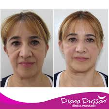 Clinica Diana Dussan