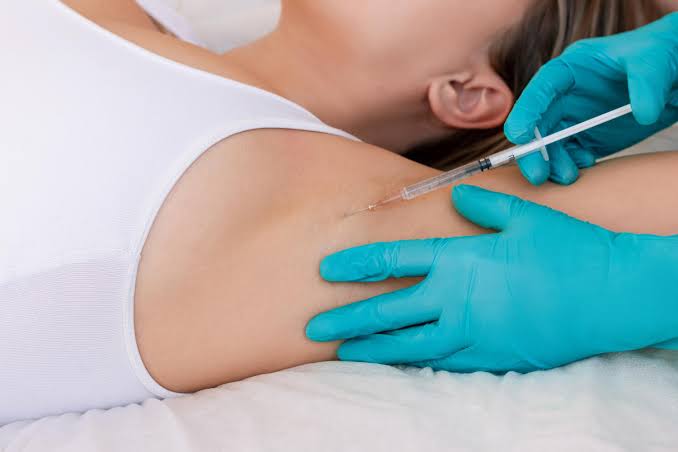 Hyperhidrosis Injection| Excessive Sweating Treatment - Portofinoclinic