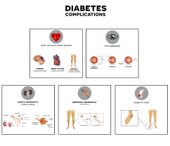 Check spelling or type a new query. Sfaturi Pentru A Evita Complicatiile Diabetului