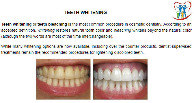 Teeth Whitening product image