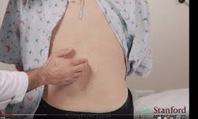 Image result for Low Back Exam