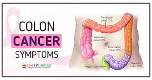 More information on these signs and symptoms can be found on the american cancer society (acs) and the american society for clinical oncology (asco) websites. 7 Dangerous Symptoms Of Colon Cancer Diagnosis And Treatment Methods