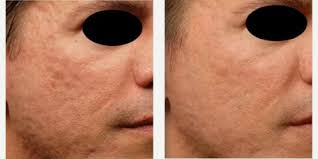 Mark H. Tseng, MD, Physician