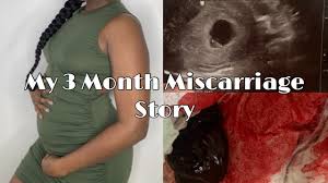 نتیجه جستجوی لغت [miscarriage] در گوگل