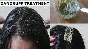 Once this is done, you can apply this on your scalp and massage your hair gently with it. Remove Dandruff Permanently In 1 Day Dandruff Treatment At Home For Hair Growth Long Hair Youtube