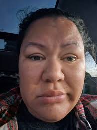 Stroke Survivor 💪🧠❤️