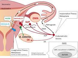 — endometriosis of uterus, adenomyosis). Relationship Between Adenomyosis And Endometriosis Different Phenotypes Of A Single Disease European Journal Of Obstetrics And Gynecology And Reproductive Biology