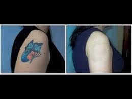 Maybe you would like to learn more about one of these? Tattoo Removal With Salt Heroic But Cheap Youtube