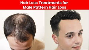 Some hair loss is associated with stress although male pattern baldness is a genetic condition found in many men. What Causes Hair Loss And What Supplement Will Stop It Oldicom Marketing