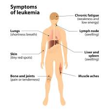 I ncreased swelling or persistent pain in bones, joints, back, or legs. Common Symptoms Of Childhood Cancer Most Common Symptoms Rxwiki