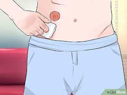 Scissors (if needed) clean towel. How To Change A Colostomy Bag 12 Steps With Pictures Wikihow