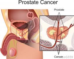 42,662 prostate massage free videos found on xvideos for this search. What Is A Prostate Massage With Pictures