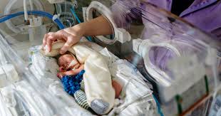 Image result for Preterm Infant Growth