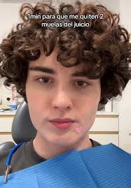 🦷🦷 Al final se me acabó pasando a los dos días… #muelasdeljuicio  #dentista #dentistaentiktok #wisdomteeth #beforeandafter #dentist